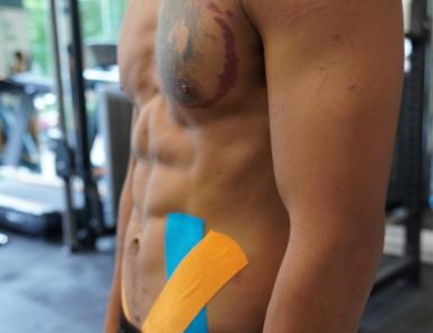 Taping Phục Hồi Công Dụng Và Ứng Dụng 